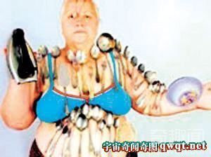 俄罗斯老妇遭雷击后成了人体磁铁