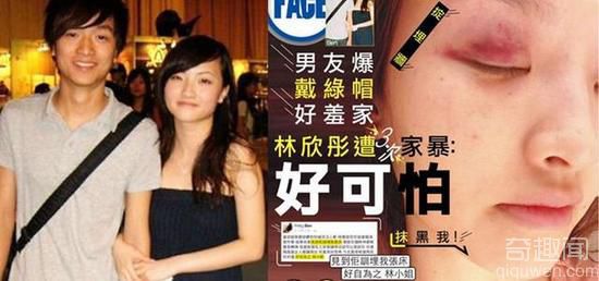 林欣彤自称遭三次家暴 其男友称被戴绿帽