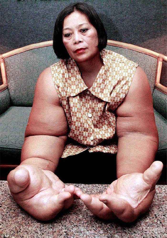 震惊！泰国妇女拥有世界上最大的手