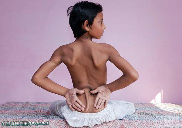 印度一男孩长着神奇尾巴 在当地被奉为神灵信徒朝拜