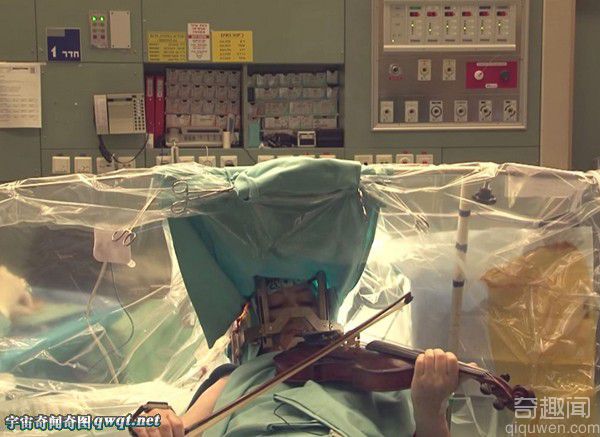 瞠目结舌！手术台上的患者竟然淡定地拉着小提琴
