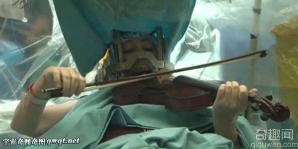 瞠目结舌！手术台上的患者竟然淡定地拉着小提琴
