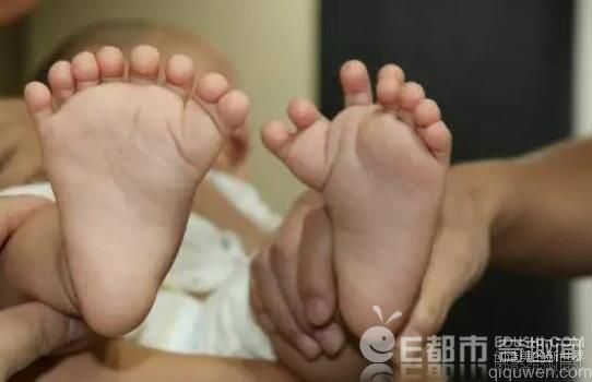 男婴长31个手指脚趾 长相很恐怖吓人