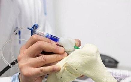 科学家发明手持式3D骨头打印机  能在体内打印骨骼