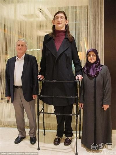 世界最高女孩身高2米13 无法站立行走