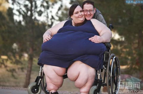 世界第一胖人 体重达1400斤