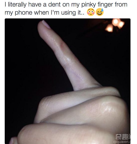 玩手机小拇指错位 看你还敢天天玩手机么
