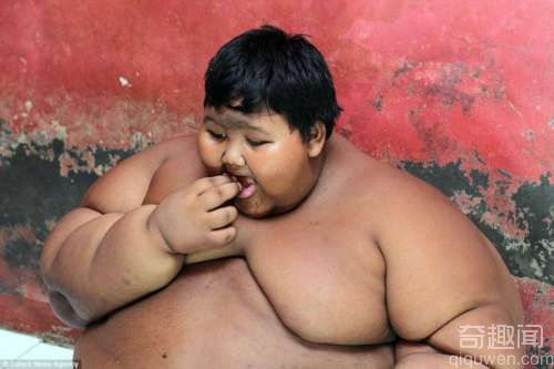 世界最胖男孩384斤 食量是普通成年人的两倍