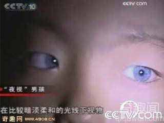 [图文]“猫眼”男孩天生长蓝色瞳孔具备神奇夜视能力