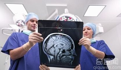 40个关于大脑的惊人事实 人类的大脑其实很可怕