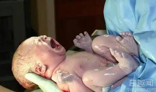 意外来的宝宝：婴儿出生时手抓避孕环