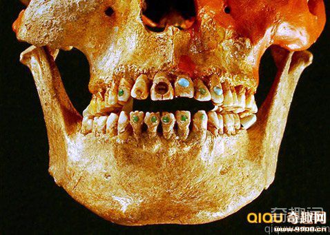 [图文]古印第安人曾流行在牙齿上镶嵌宝石 非常精湛的技艺