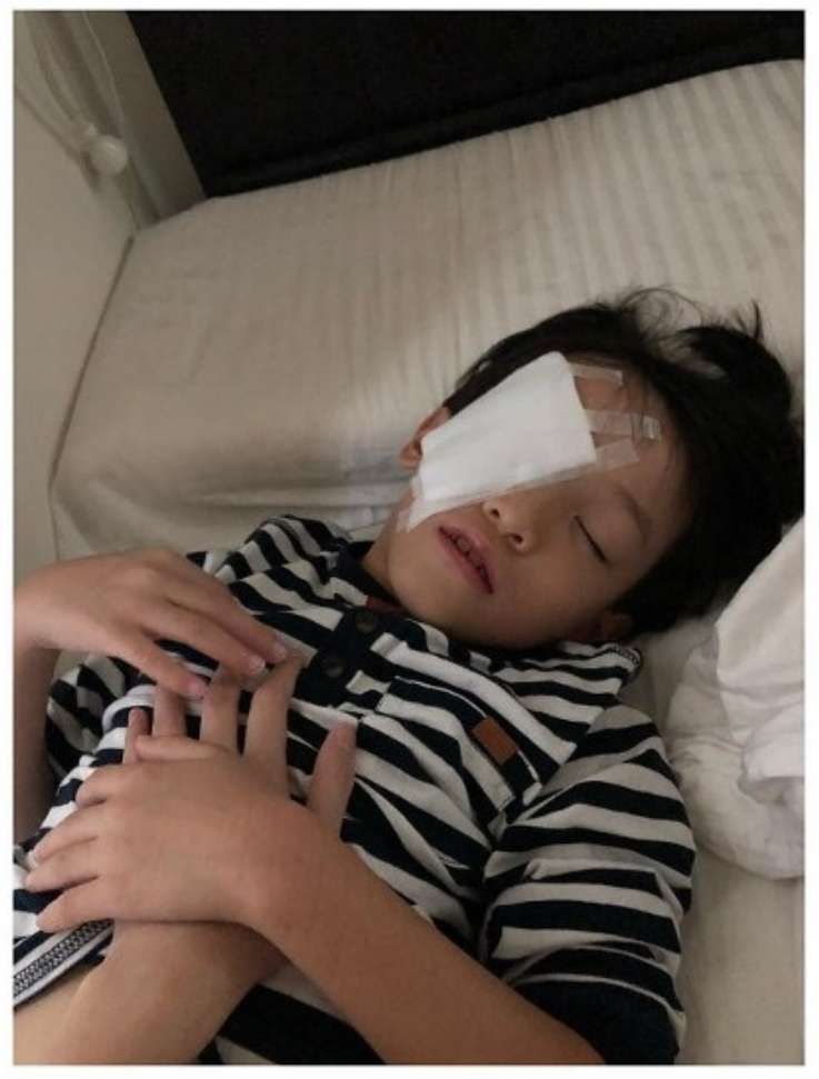 香港男星6岁儿子惨遭铅笔插眼睛，右眼遮纱布视网膜受损