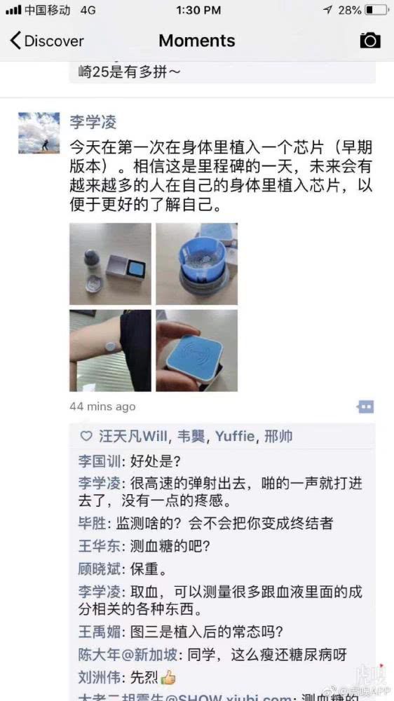 李学凌真的往体内植入芯片了？有可能是被忽悠了