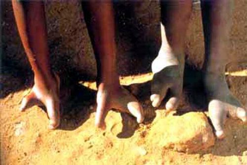 非洲这个奇异的民族，居民只有两个脚趾，被称为“鸵鸟人”