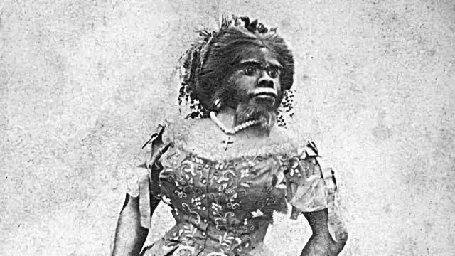 世界上最丑的女人，被当做怪物在马戏团演出，死后被丈夫做成标本