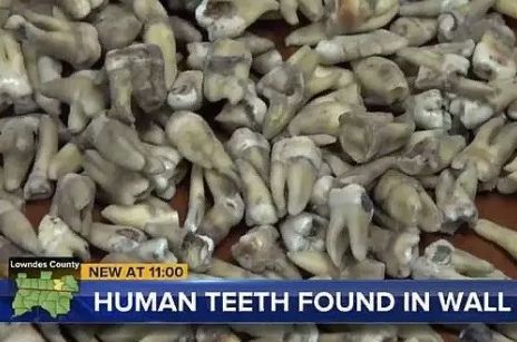 男子拆墙体掉下一堆牙齿，没有人知道其中缘由，至今还是个谜