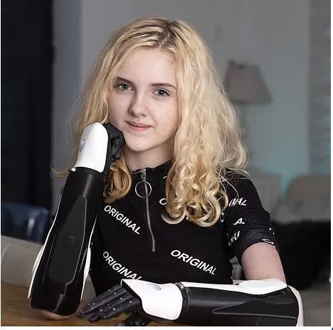 13岁女孩成现实版阿丽塔，卡梅隆为其打造酷炫机械臂