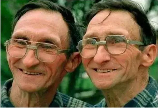 震惊！厦门一对双胞胎竟是同母异父？概率百万分之一！只因母亲……