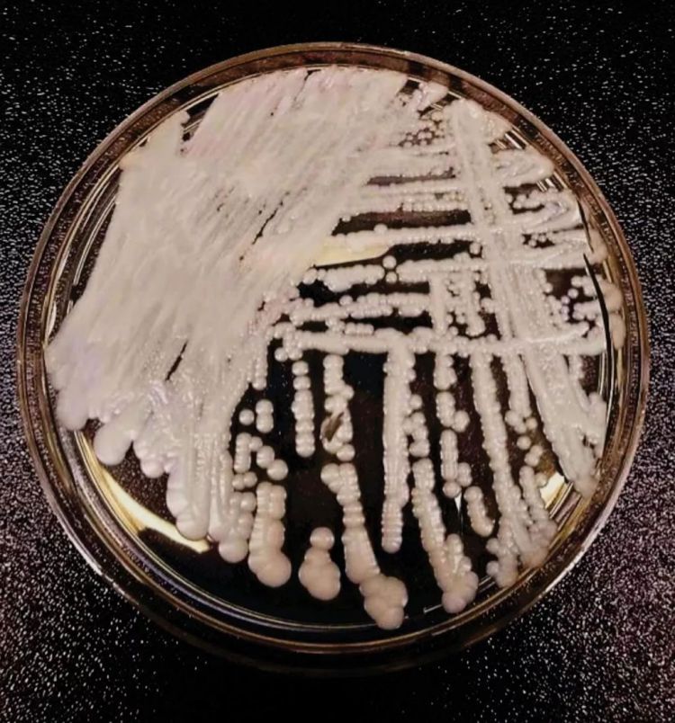 致死率60%的超级真菌被美国列为“紧急威胁”，中国已有18例确认感染