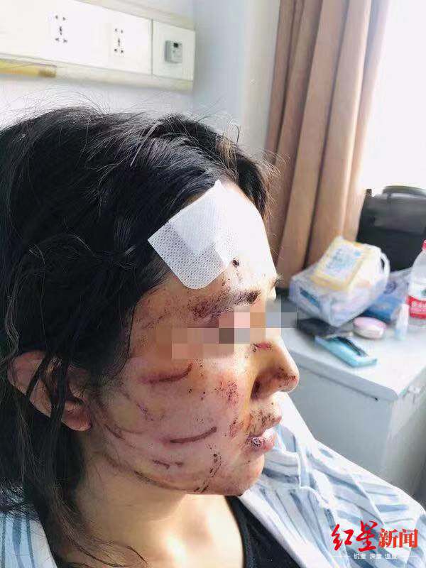 温州女子当街被公公丈夫暴打毁容涂大便，当地警方立案侦查