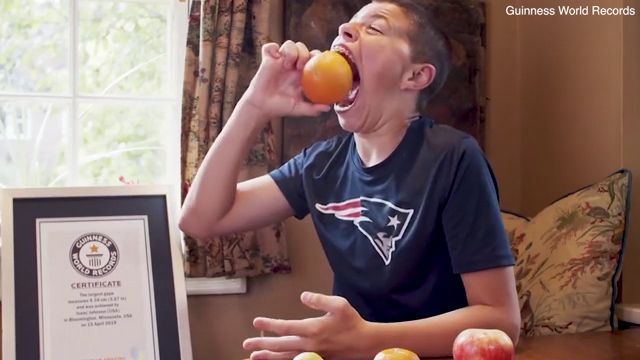 奇葩！美国14岁男孩嘴巴张大破纪录 可以塞进橙子和苹果