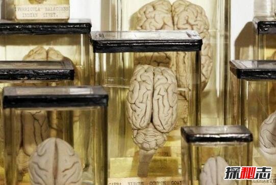 泰国恐怖博物馆，收藏畸形尸体的变态博物馆(信不信由你)