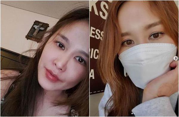 韩国女星蔡丽娜自曝整形后遗症：没办法戴口罩
