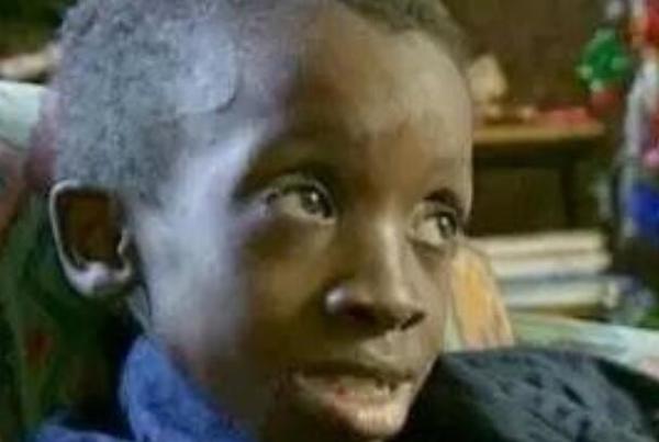 世界上活得最久的艾滋病患者：恩科西，12年(南非)