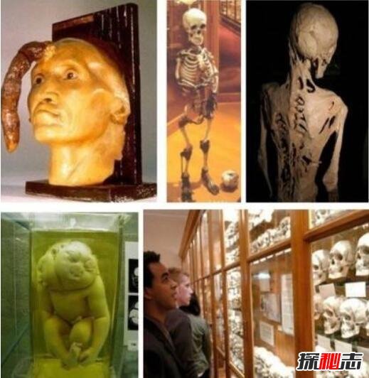 世界上最恐怖的博物馆，美国费城马特博物馆(尸骨成堆)