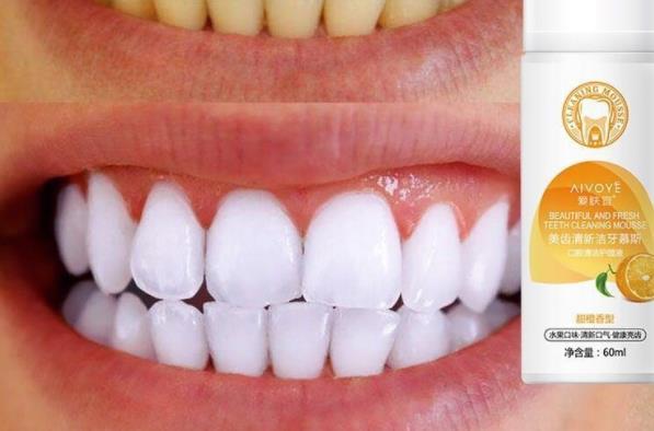 洁牙慕斯真的能刷白黄牙吗 怎么样可以让牙齿更白
