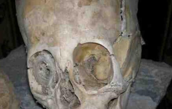 巨頭干尸是什么：疑似外星人的干尸，頭骨比人類大很多