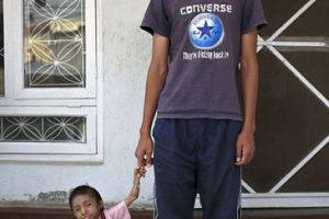 [多图]尼泊尔男孩即将获得世界第一小人头衔 体重只有10磅
