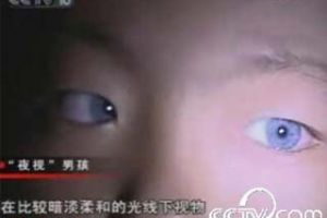 [图文]“猫眼”男孩天生长蓝色瞳孔具备神奇夜视能力