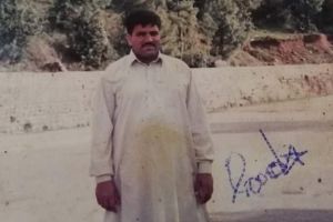 巴基斯坦男子患象皮病左腿肿胀至150公斤