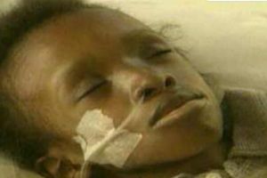 世界上活得最久的艾滋病患者：恩科西，12年(南非)