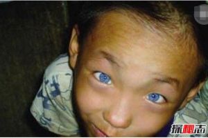 廣西9歲貓眼男孩之謎，天生藍瞳孔具有夜視眼(視頻/真相)