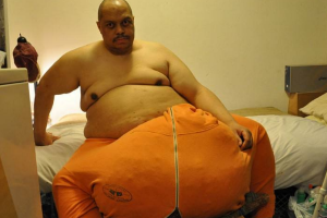 世界上最大的睪丸:重達120斤(沒有適合他的褲子)
