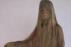 世界上體毛最長的人艾米麗·蘇珊:毛發遮面似猿人