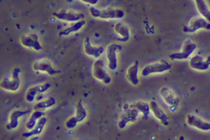 食脑虫会吃人脑吗 诱发脑膜炎潜伏期短(99%死亡率)